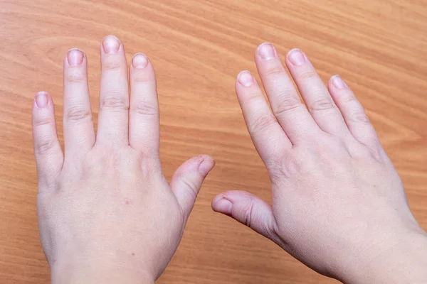 Großaufnahme Weiblicher Hände Mit Natürlichen Rohen Schmutzigen Nägeln Auf Holzgrund — Stockfoto