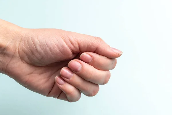 Close-up de uma mão feminina caucasiana com unhas naturais não polidas, cutícula coberta em um fundo branco — Fotografia de Stock