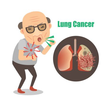 Akciğer kanserinden öksüren yaşlı bir adam.