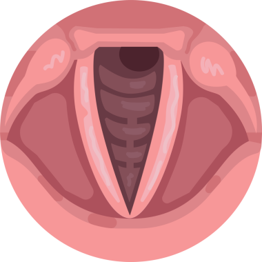 İnsan gırtlağının kesiti ses tellerini gösteriyor.