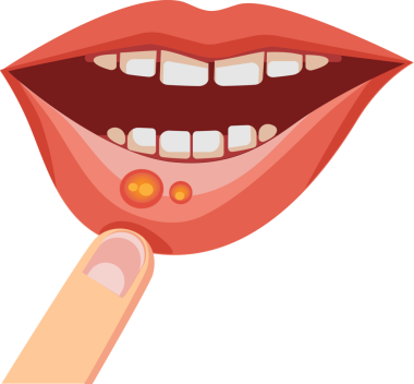 Görünür yaralarla parmakları birbirine değdi.