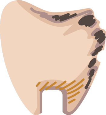 Diş parçasının görüntüsünü kapat