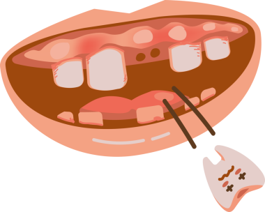 Diş ve diş aletlerini gösteren ağzını aç
