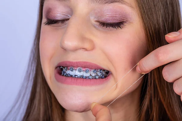 Primer Plano Retrato Una Adolescente Feliz Con Frenillos Hermosa Sonrisa — Foto de Stock