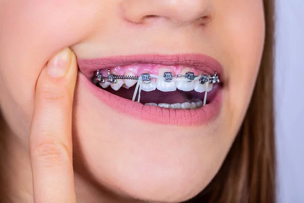 Primer Plano Retrato Una Adolescente Feliz Con Frenillos Hermosa Sonrisa — Foto de Stock