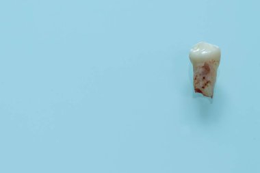 yakın plan süt dişleri çıkarıldı