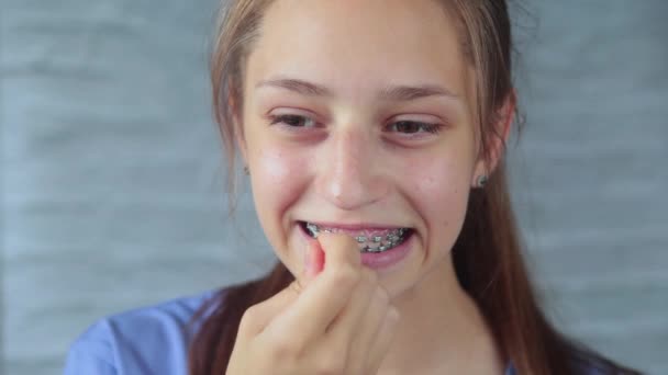 Teenager Pulizia Dei Denti Con Bretelle Vicino — Video Stock