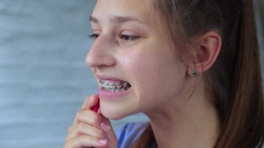 Diş telleriyle diş temizleyen bir genç. Kapat.