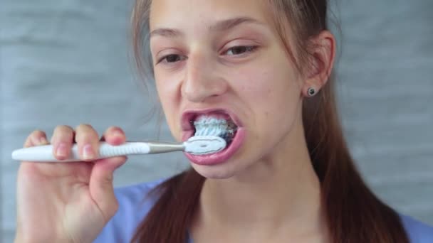 Teenager Putzen Zähne Mit Zahnspangen Nahaufnahme — Stockvideo