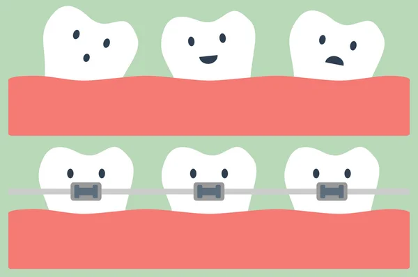 Dientes de dibujos animados ortodoncia — Archivo Imágenes Vectoriales