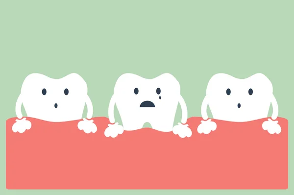 Doença periodontal dos dentes —  Vetores de Stock