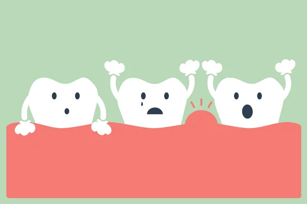 Enfermedad periodontal dental — Archivo Imágenes Vectoriales