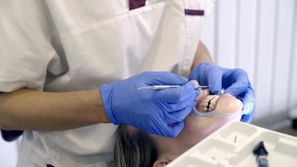 Врач Стоматолог Осматривает Зубы Пациента — стоковое видео