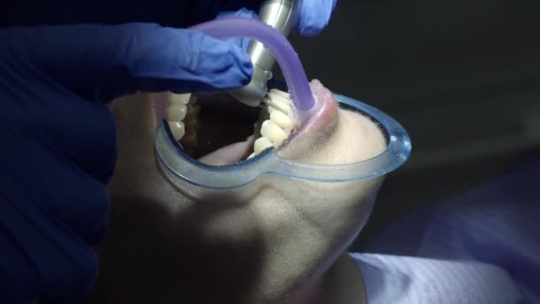Zarovnání Zubů Klinice — Stock video