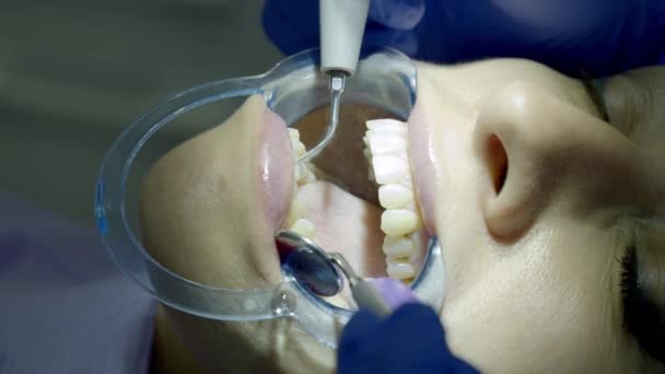 Ευθυγράμμιση Δοντιών Στην Κλινική — Αρχείο Βίντεο
