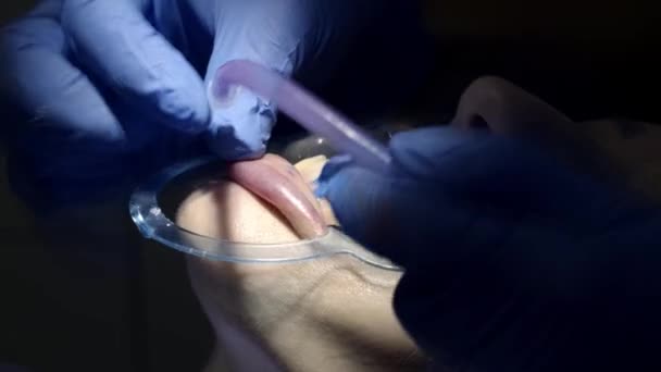 Οδοντιατρική Περίθαλψη Στην Κλινική — Αρχείο Βίντεο