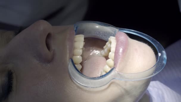 Badanie Stomatologiczne Dentysty — Wideo stockowe