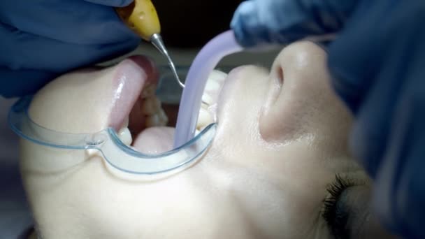 Examen Dentaire Par Dentiste — Video