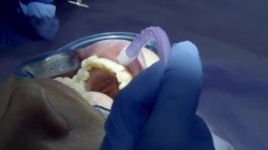 Dişçide dişlerini parlatıyor.