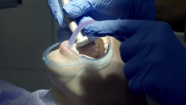 Tandpolering Hos Tandläkaren — Stockvideo