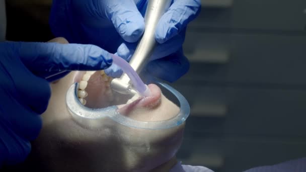 Polissage Des Dents Chez Dentiste — Video