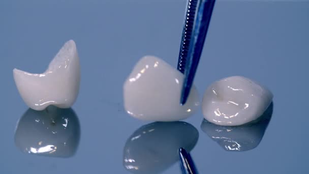 Prezentare Fatete Dentare Clinica — Videoclip de stoc