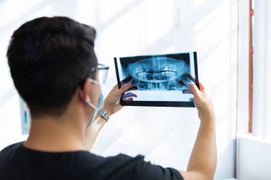 Dişçi kliniğinde bir radyografiyi inceliyor.