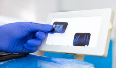 Diş Hekimliği: Dişçinin Diş Röntgeni