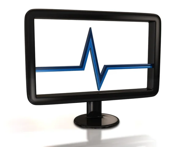 Monitor with puls graph on  screen — Stock Photo, Image