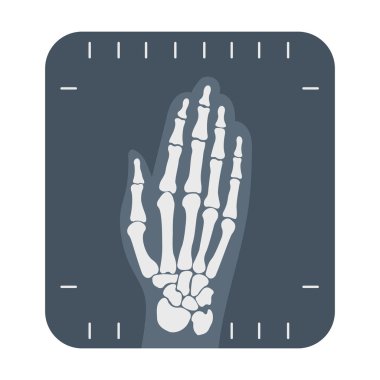 X-ray hand icon cartoon. Single medicine icon from the big medical, healthcare set.
