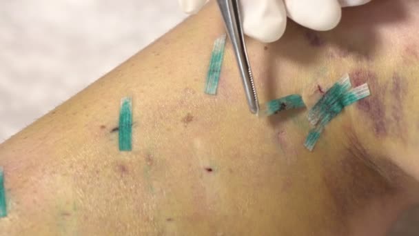 Sutuur (geologie) verwijdering, platen met benen onder de knie, close-up — Stockvideo