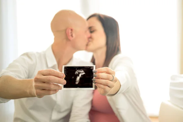 Young Couple Kisses Happy Show Ultrasound Baby Husband Wife Happy — Stock Photo, Image