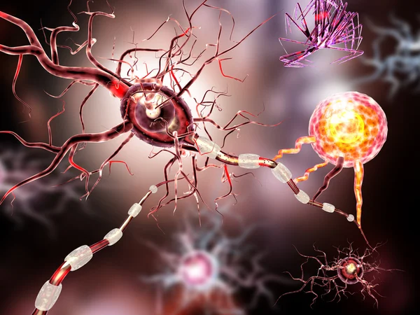 Cellule nervose, concetto di malattie neurologiche, tumori e chirurgia cerebrale — Foto Stock