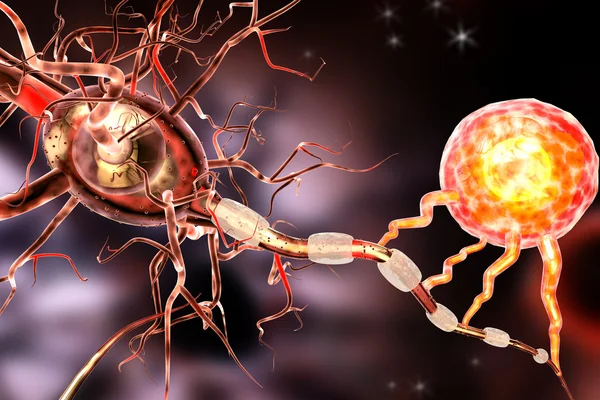 Nerve cells, concept for Neurological Diseases, tumors and brain surgery — Stock Photo, Image