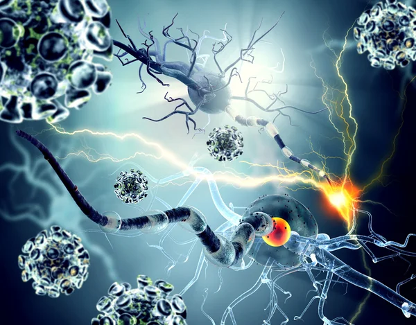 Nervenzellen, Konzept für neurologische Erkrankungen, Tumore und Gehirnchirurgie — Stockfoto