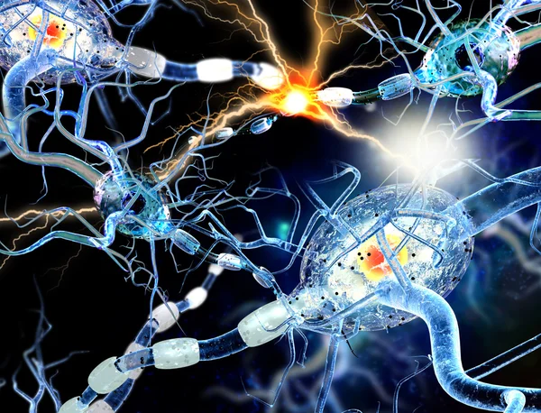 Células nerviosas, concepto de enfermedades neurológicas, tumores y cirugía cerebral —  Fotos de Stock