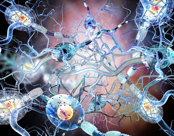 Nervceller, koncept för neurologiska sjukdomar, tumörer och hjärnkirurgi — Stockfoto