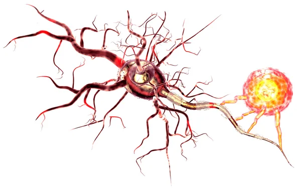 Cellule nervose, concetto di malattie neurologiche, tumori e chirurgia cerebrale — Foto Stock