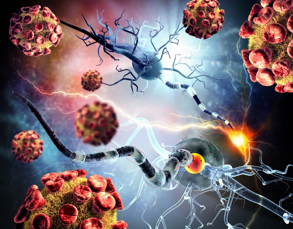 Nervceller, koncept för neurologiska sjukdomar, tumörer och hjärnkirurgi — Stockfoto