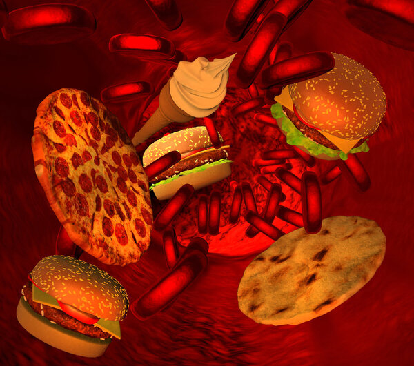 Cholesterol blocked artery