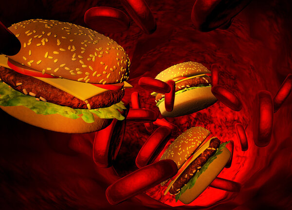 Cholesterol blocked artery