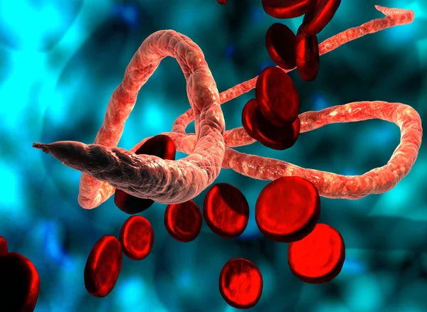 Vírus do ébola — Fotografia de Stock