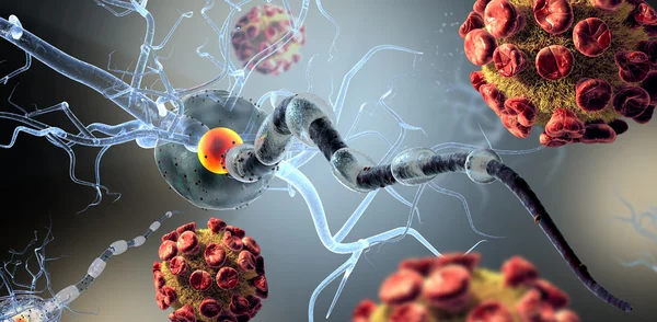 High quality 3d render of viruses attacking nerve cells, concept for Neurologic Diseases, tumors and brain surgery. — Stock Photo, Image