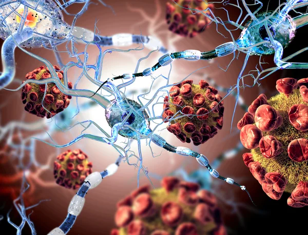 Renderização 3d de alta qualidade de vírus atacando células nervosas, conceito para doenças neurológicas, tumores e cirurgia cerebral . — Fotografia de Stock