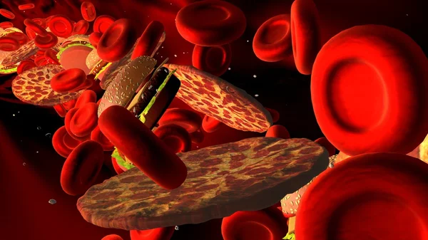 Clogged Artery with platelets and cholesterol plaque — Stock Photo, Image