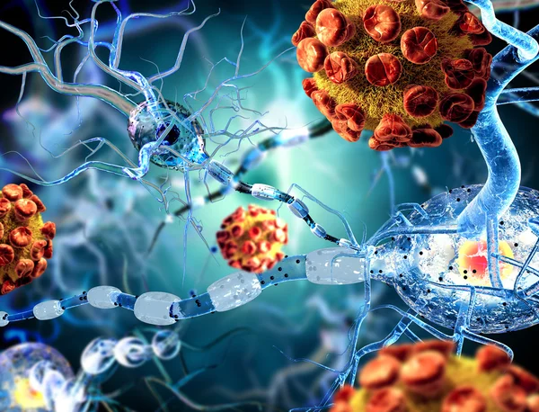 Nerve cells en virus, koncept för neurologiska sjukdomar, tumörer och hjärnkirurgi. — Stockfoto