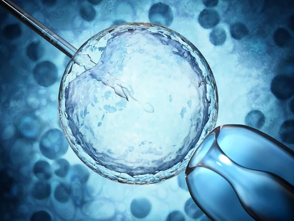 Illustration Processus Insémination Artificielle Montrant Des Spermatozoïdes Injectés Intérieur Ovule — Photo
