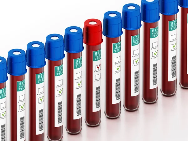 Vzorky Krve Injekčních Lahvičkách Nálepkami Hiv Testech Izolovanými Bílém Pozadí — Stock fotografie