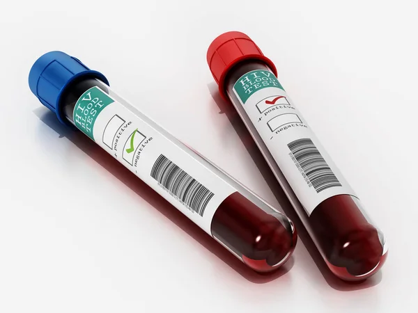 Hiv検査ラベルのあるバイアルで陽性および陰性の血液サンプル 3Dイラスト — ストック写真