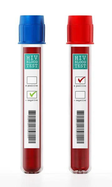 Pozitív Negatív Vérminták Hiv Tesztcímkével Ellátott Injekciós Üvegekben Illusztráció — Stock Fotó